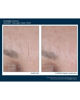 AlphaRet® Overnight Cream FACE, 30 ml