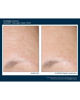 AlphaRet® Overnight Cream FACE, 30 ml
