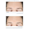 Extra Strength Active Peel Brightening System